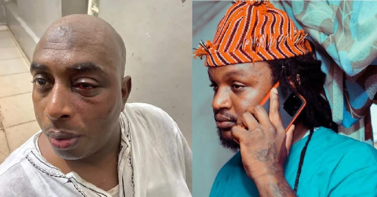 Business Man Who Was Allegedly Beaten by Boss La Finally Speaks Out