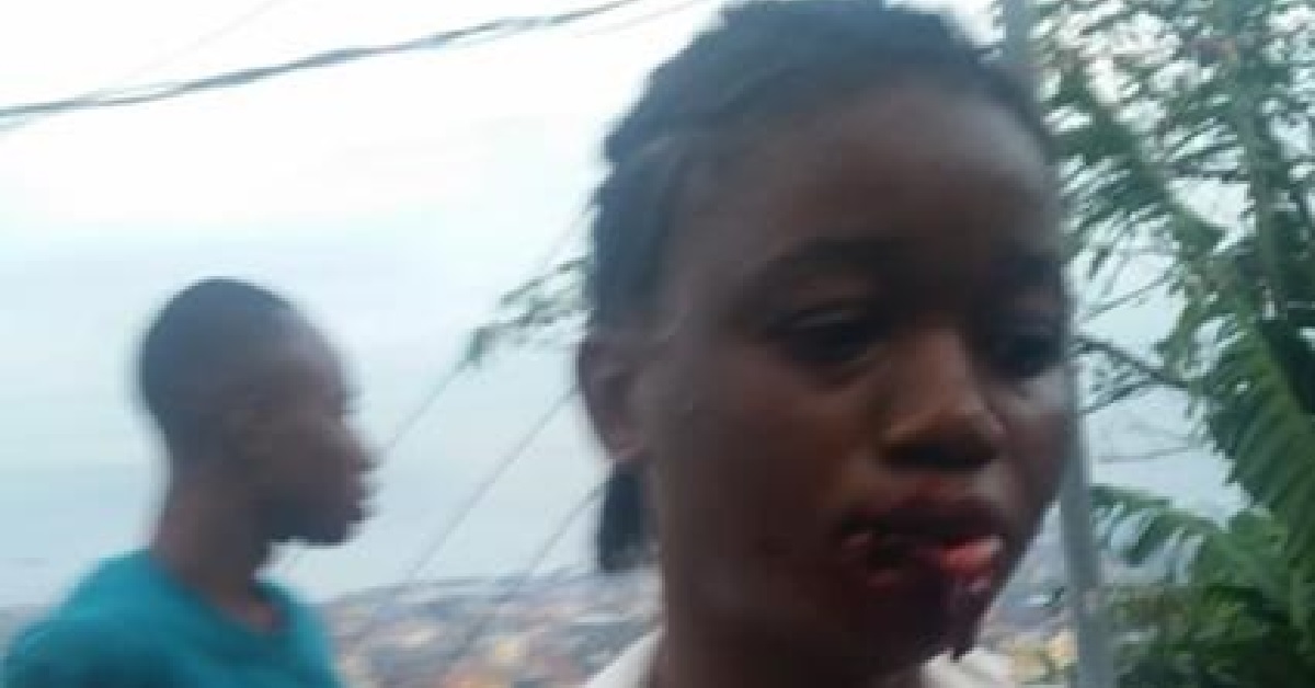 23yrs-Old Lady Lips Bitten Off For Cookery