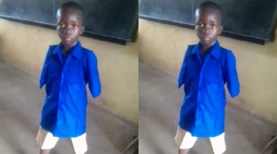 Passionate Sierra Leoneans Seeks Help to Locate Boy Born Without Hands