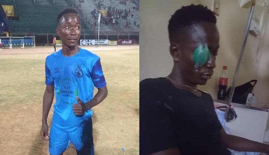 Sierra Leone Police FC Player, Issa Kamara Requires Emergency Eye Surgery in Ghana After Gruesome Accident