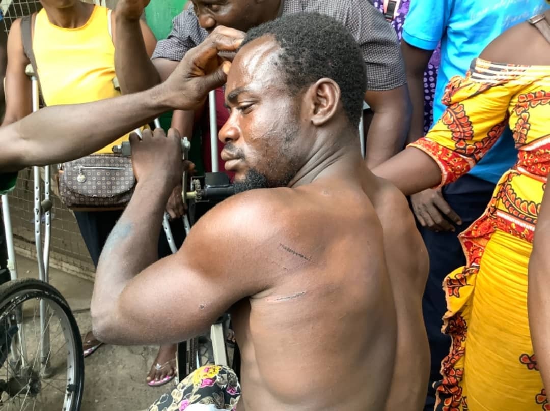 Sierra Leone Disabled Allegedly Assaulted And Maltreated by Police Officers After Their Land Was Grabbed in Freetown