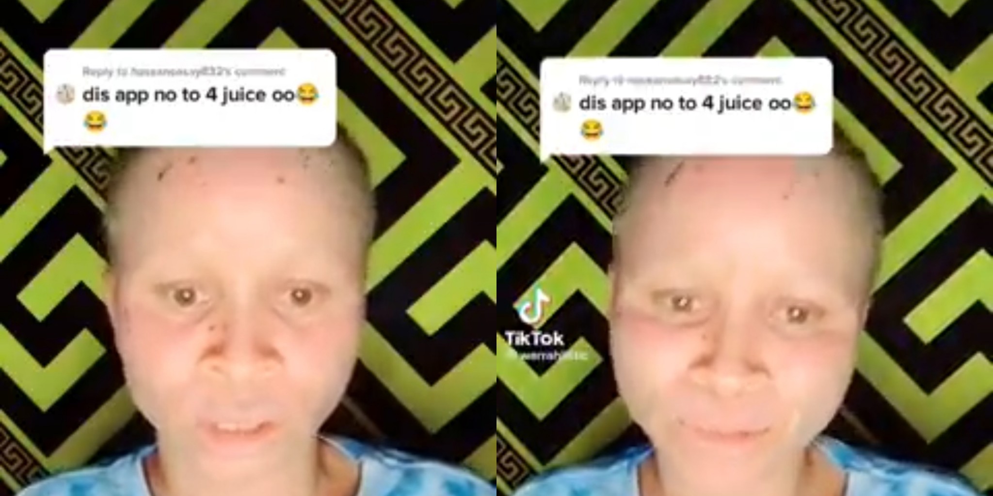 Sierra Leonean Albino Lady Reacts Over Discrimination on TikTok