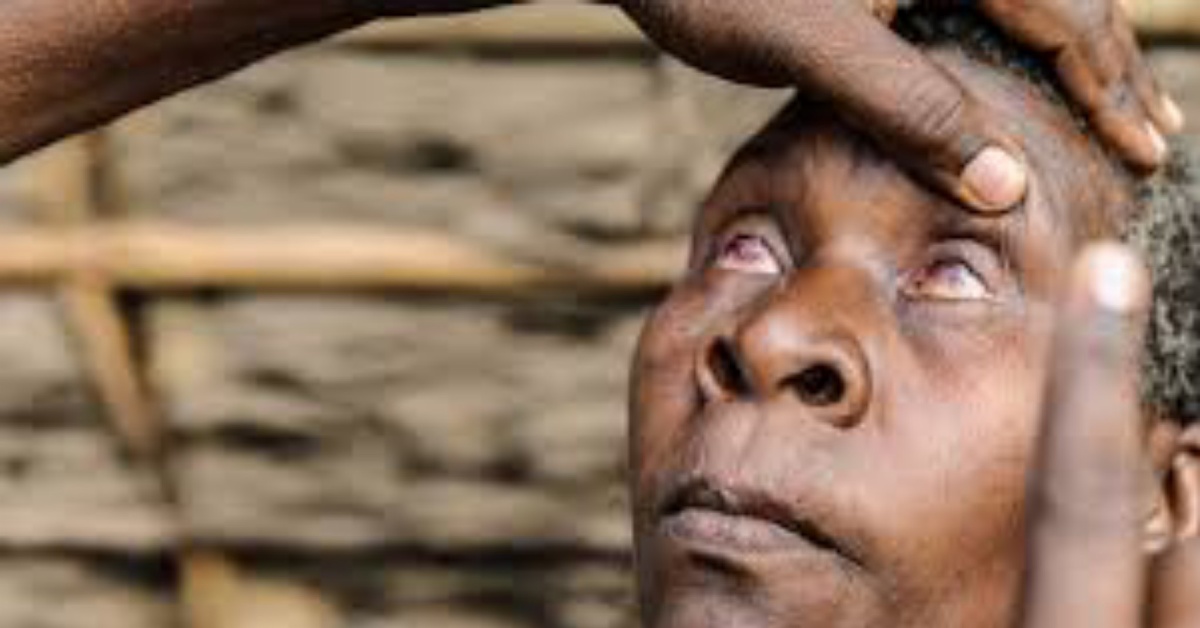 Two Accused of Throwing Acid on Woman’s Eyes in Kenema