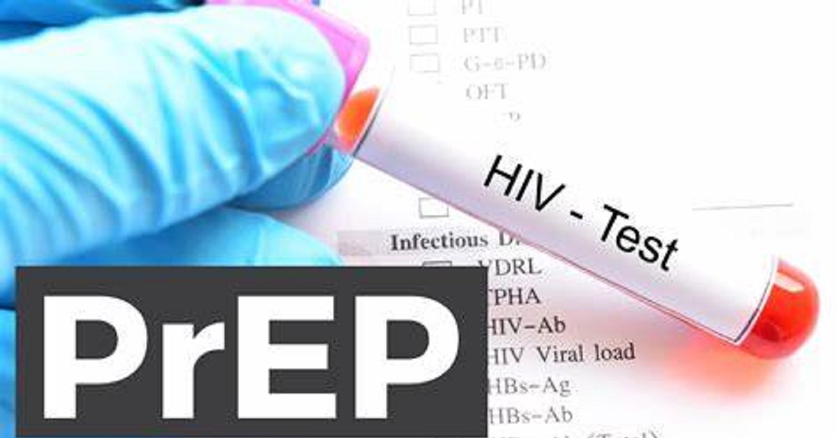 Group Advises on HIV Prevention