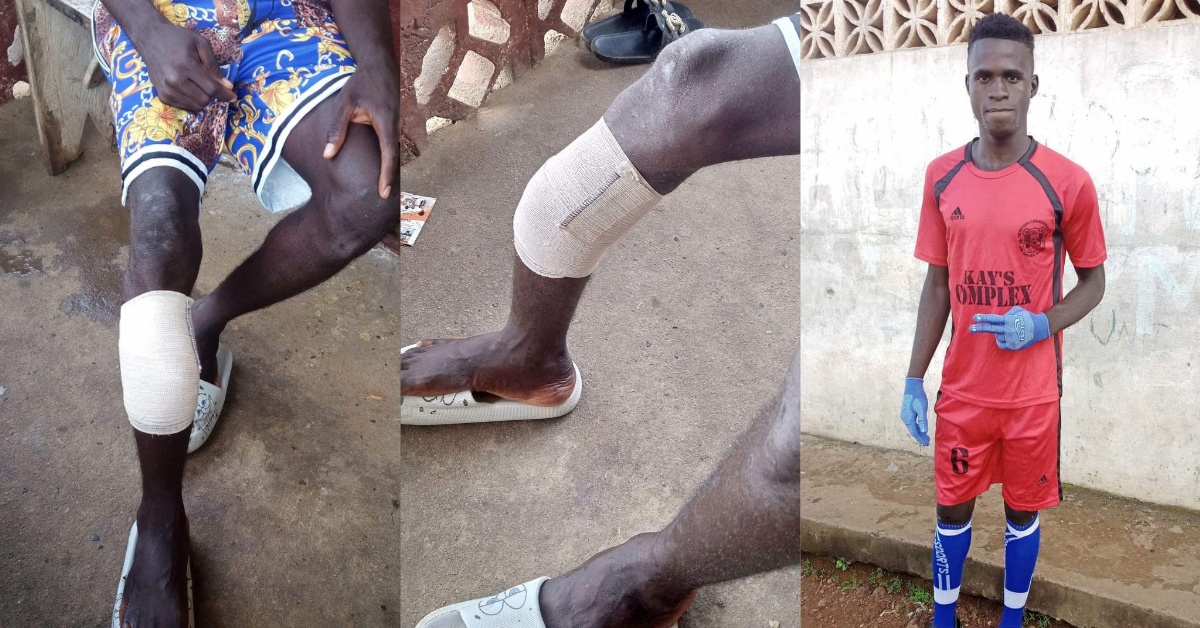 Injured Footballer Alie Kanu Pleads For Support to Save His Career After Friendly Match Injury Shatters Right Foot