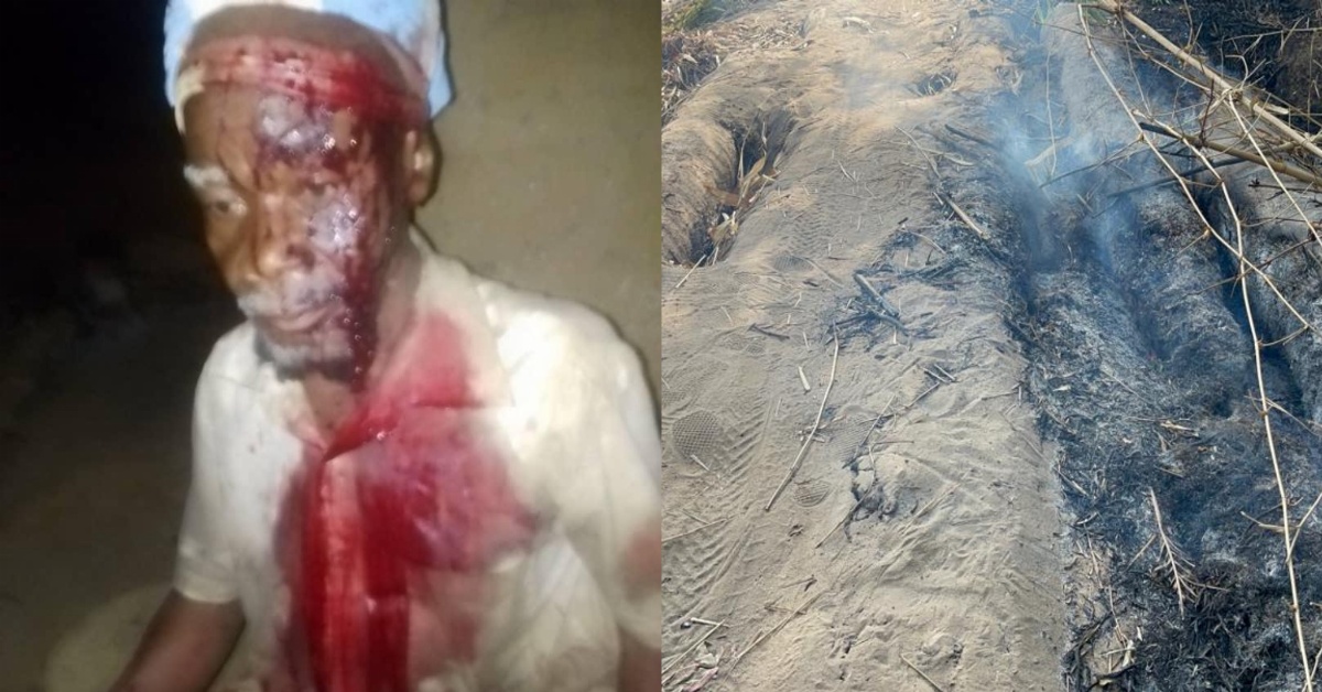 Imam Mercilessly Beaten by Alleged Poro Society Members in Moyamba District