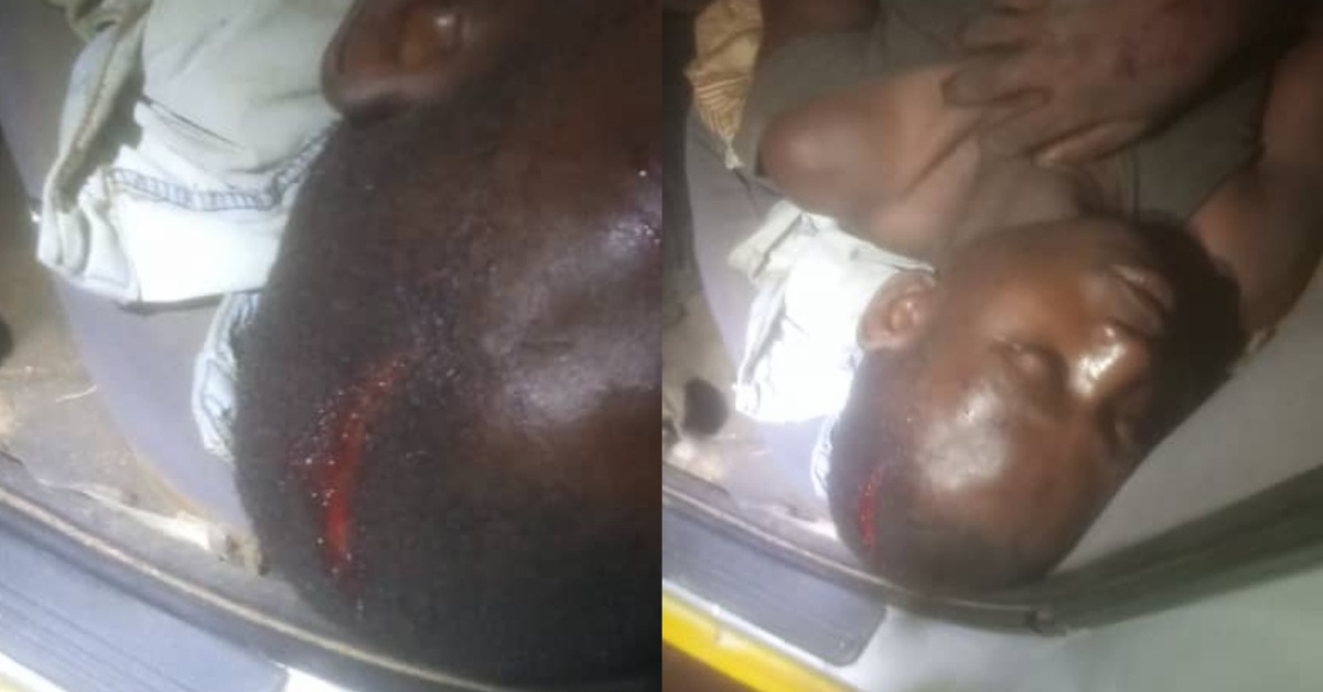 Man Brutally Injured over Firewood Theft in Mosorie Village, Moyamba District