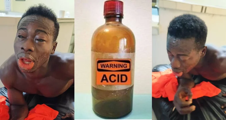 Man Whose Rival Poured Acid On in Mile 91 Permanently Goes Blind, Cries For Justice