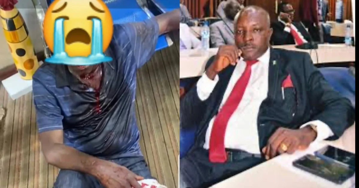 APC Emmanuel Saidu Conteh Sustain Severe Injures After Attack