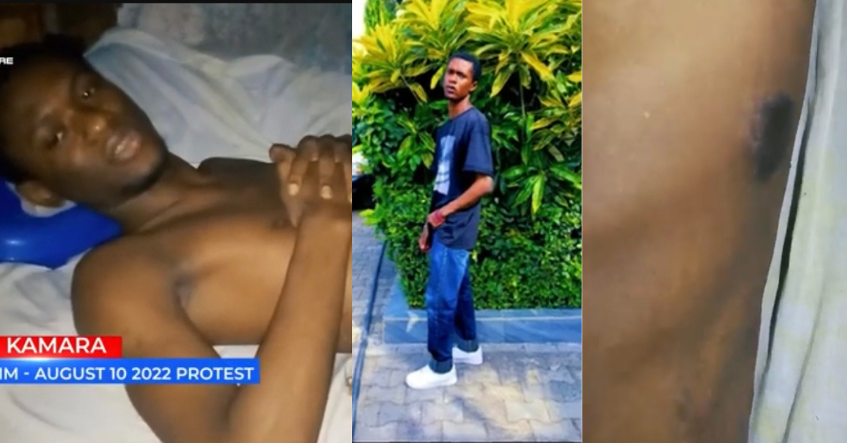 “The Bullet Went Through My Hand and Is Still in My Ribs” – August 10 Victim Cries for Help