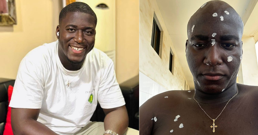 Akmed Sidi Kamara aka Black Coffee – A Beacon of Hope Extinguished Too Soon