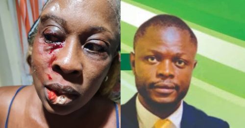 CID Receives Domestic Violence Complaint Against Former SLPP MP During 16 Days of Activism in Sierra Leone